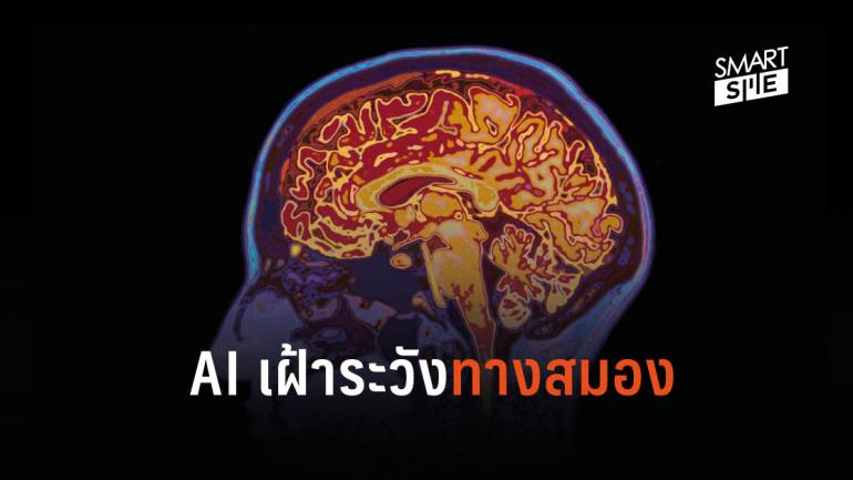 AI จะพลิกโฉมการดูแลผู้ป่วยและบาดเจ็บทางสมอง